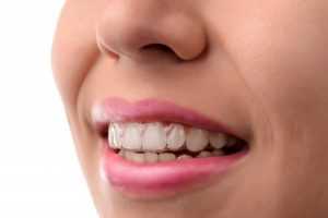  Teeth Straightening In UK