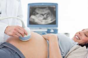 Pregnant Woman Getting Ultrasound