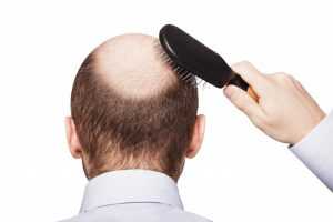 Adult man holding comb on bald head