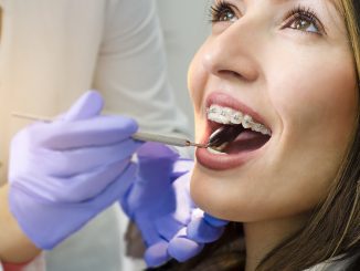 Girl With Braces