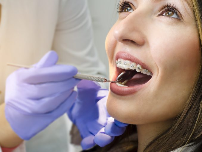 Girl With Braces