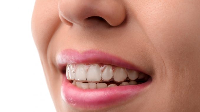 Picture of a woman's white teeth Picture of a woman's white teeth