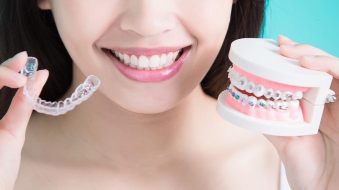 Woman holding an invisible braces and a denture Woman holding an invisible braces and a denture