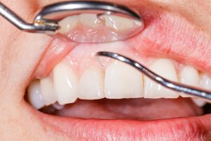 Dental Health and Oral Care