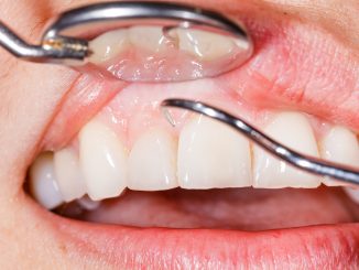 dentist checking patient's gums
