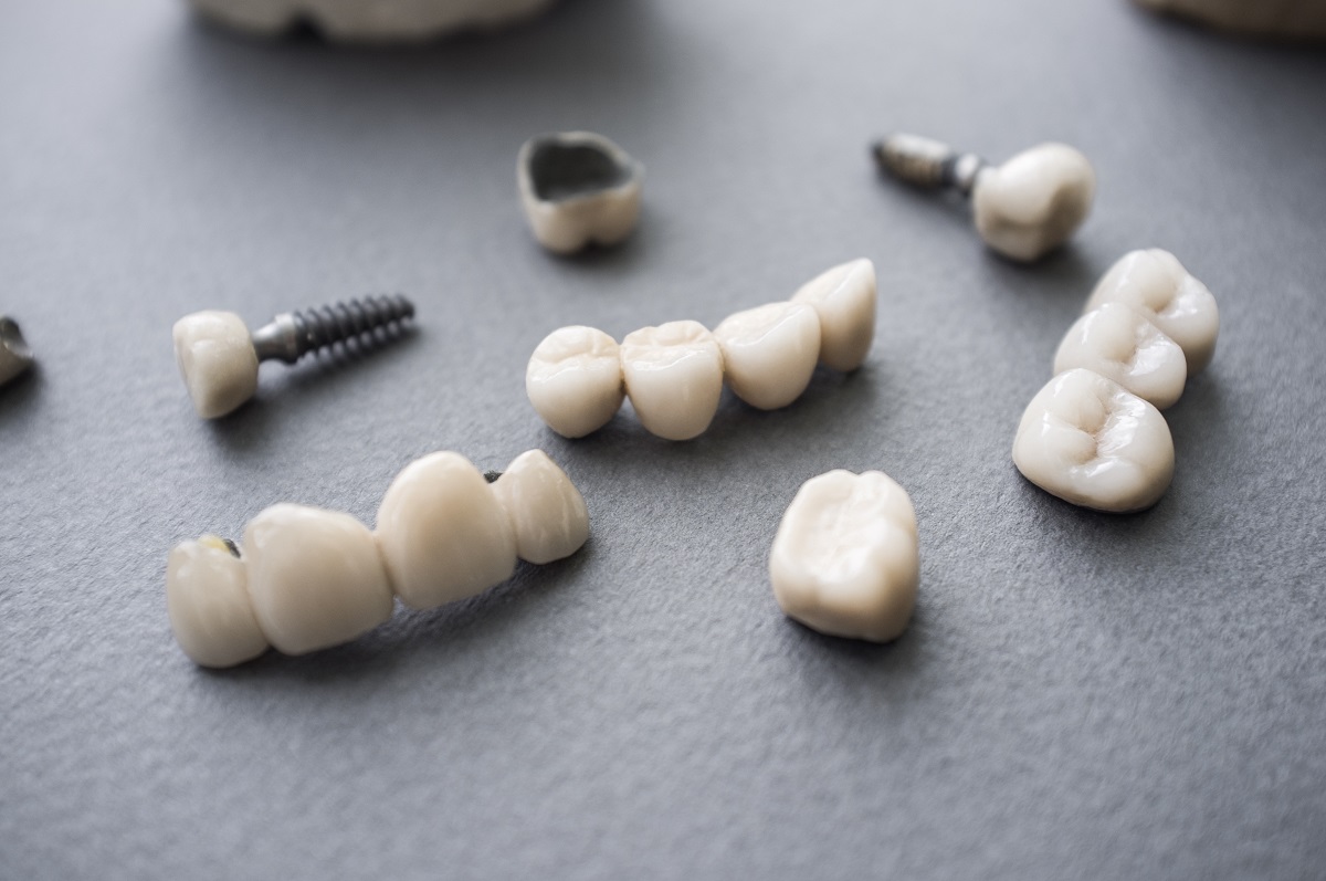 array of oral implants
